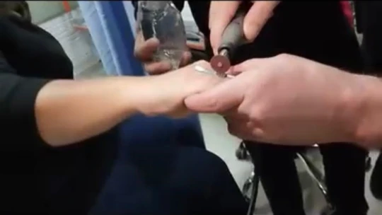 Elazığ'da parmağa sıkışan yüzüğü itfaiye ekipleri çıkardı