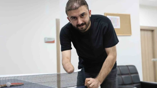 Sağ eli ve sol dizini kaybetti, yaşam sevincini kaybetmedi