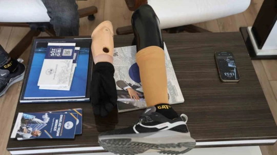 Sağ eli ve sol dizini kaybetti, yaşam sevincini kaybetmedi