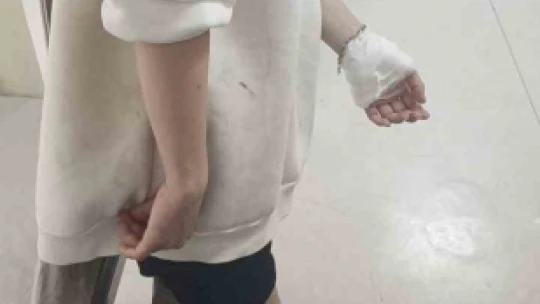 Sokak köpeklerinin saldırısına uğrayan 17 yaşındaki kız yaralandı