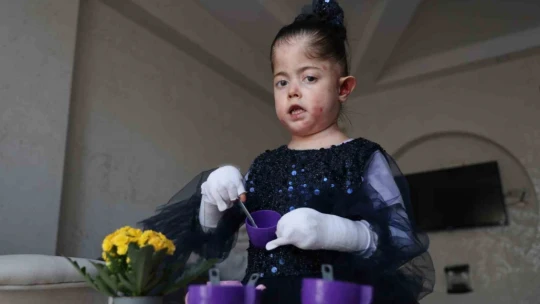 Tek dileği kelebek hastası kızına doyasıya sarılabilmek