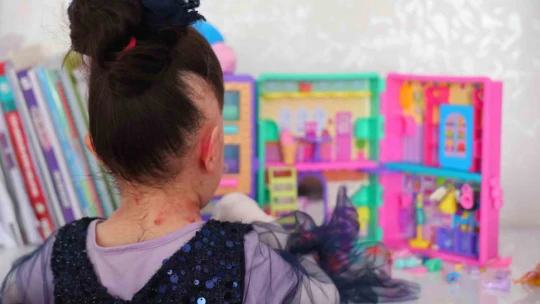 Tek dileği kelebek hastası kızına doyasıya sarılabilmek